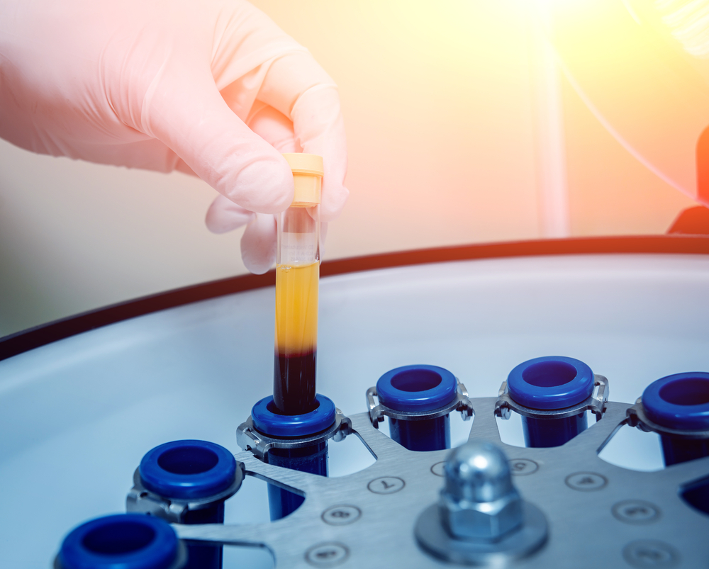 Platelet Rich Plasma Therapy