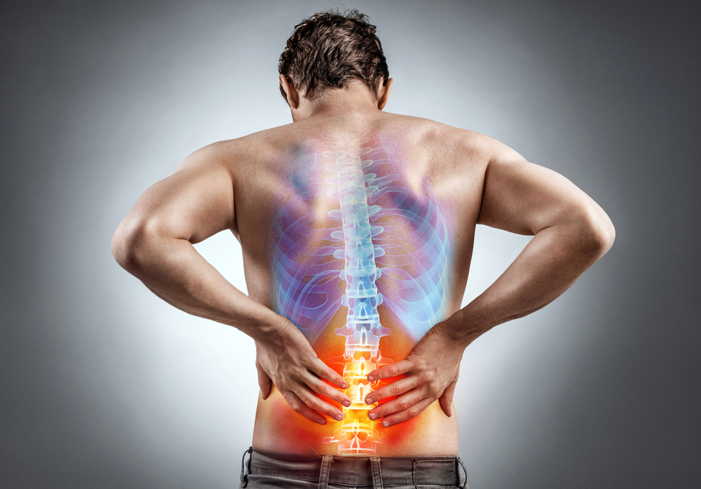 Epidural Steroid Injection for Back Pain: How Long Does It Last