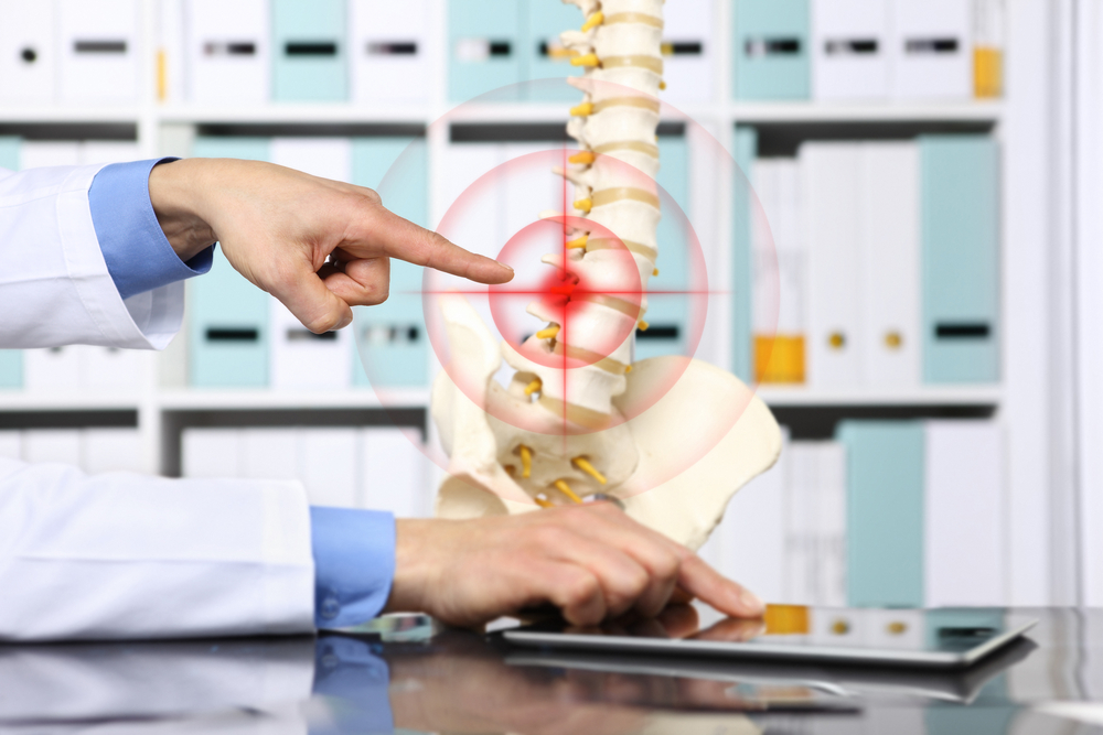 kyphoplasty for vertebral fractures