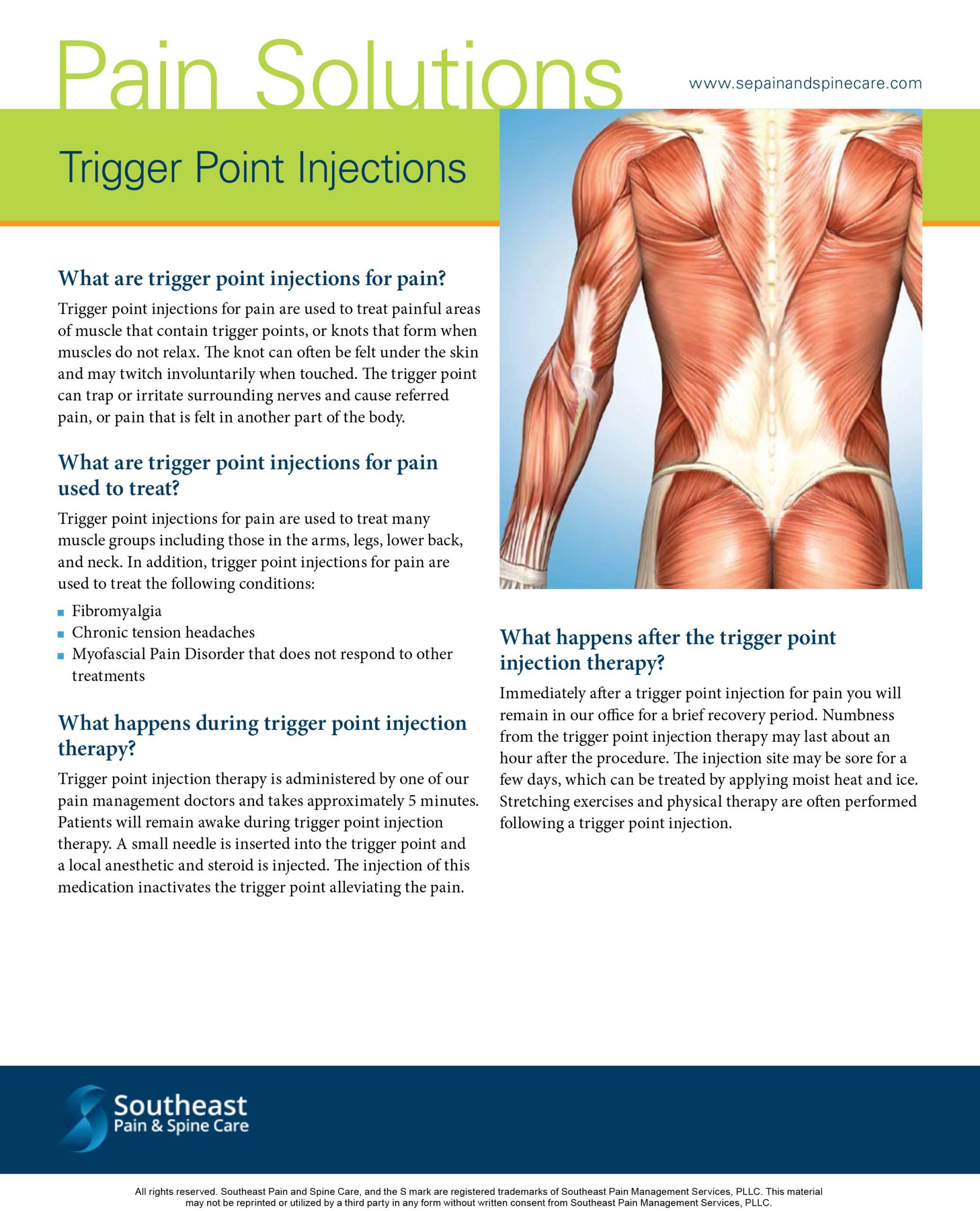 Trigger Point Injections