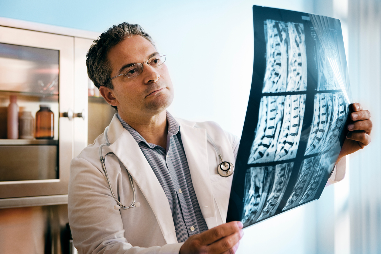 spinal fusion