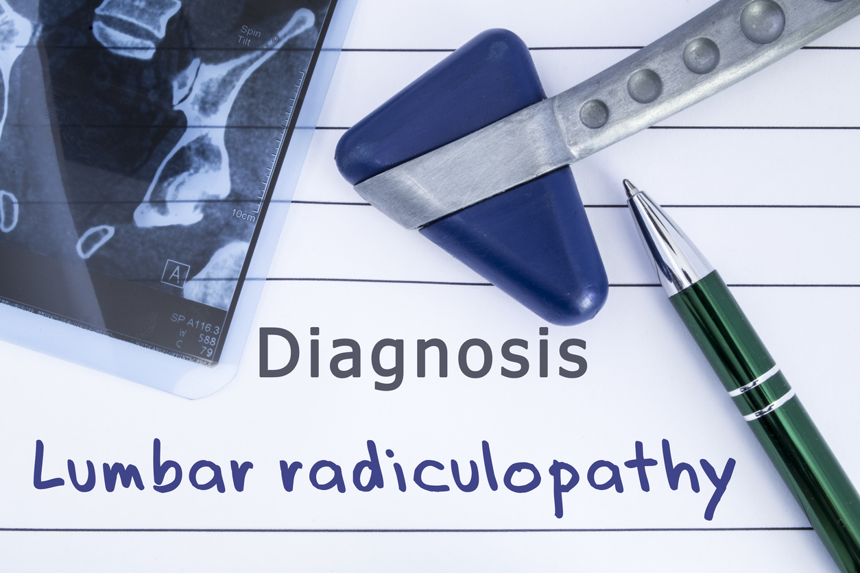 what is lumbar radiculopathy