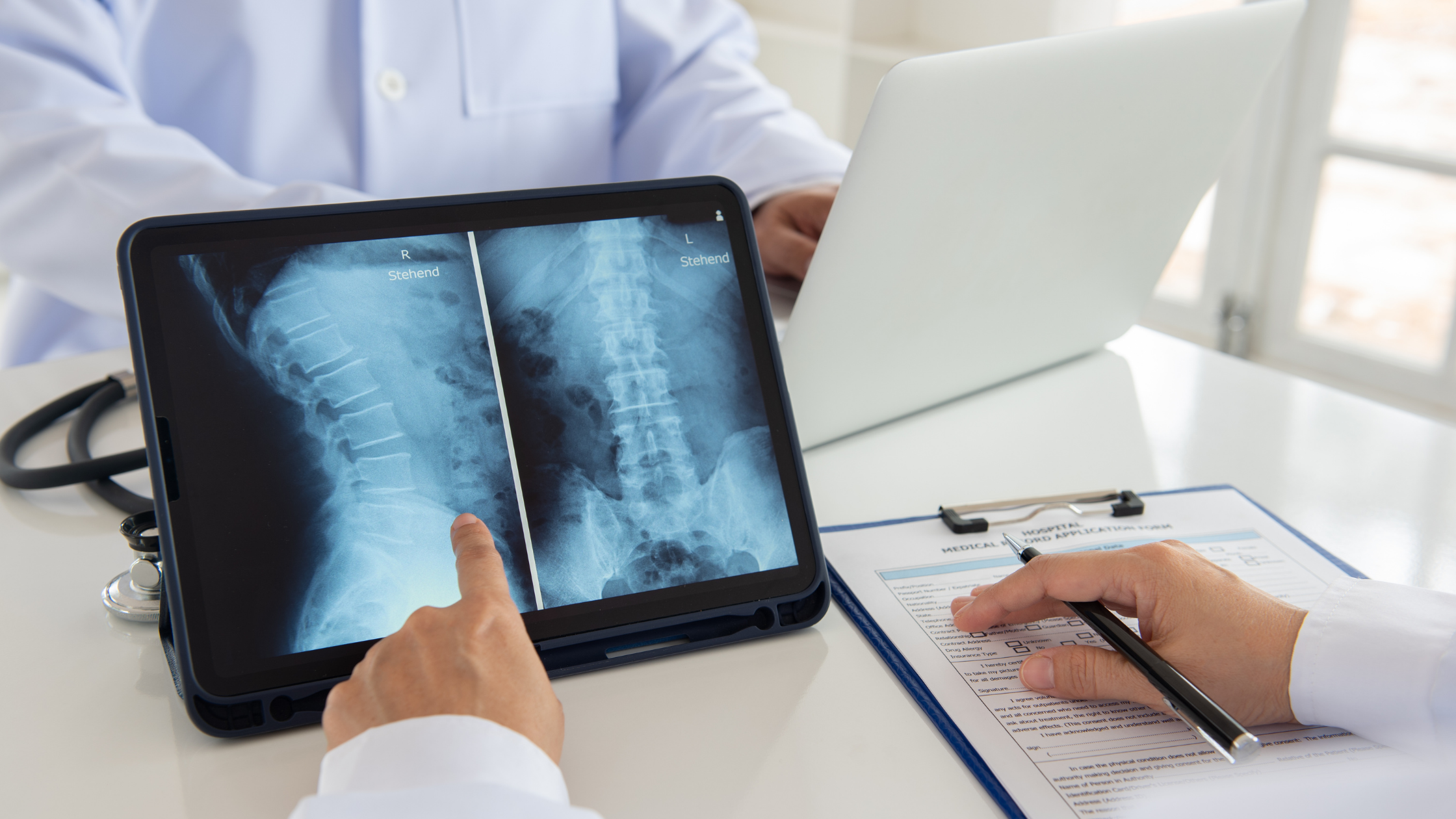 lumbar radiculopathy treatments
