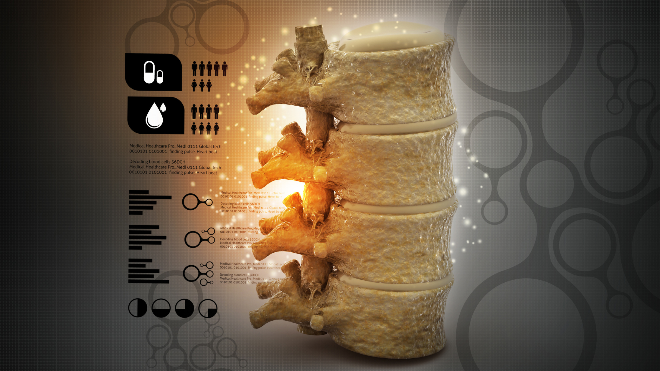 spinal cord stimulators