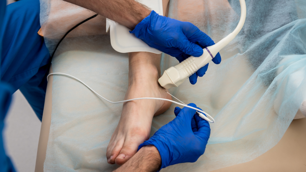 Understanding Radiofrequency Ablation for Chronic Pain Relief