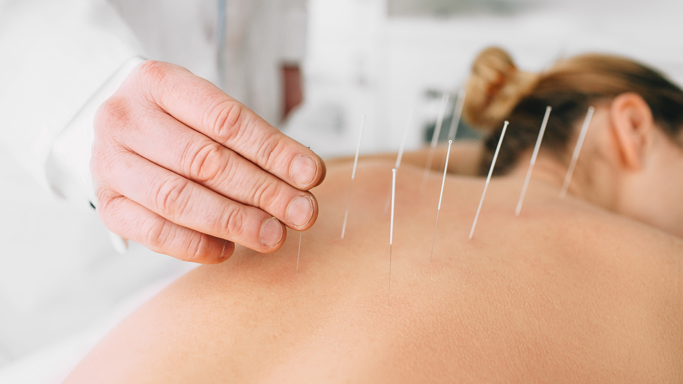 acupuncture for chronic pain